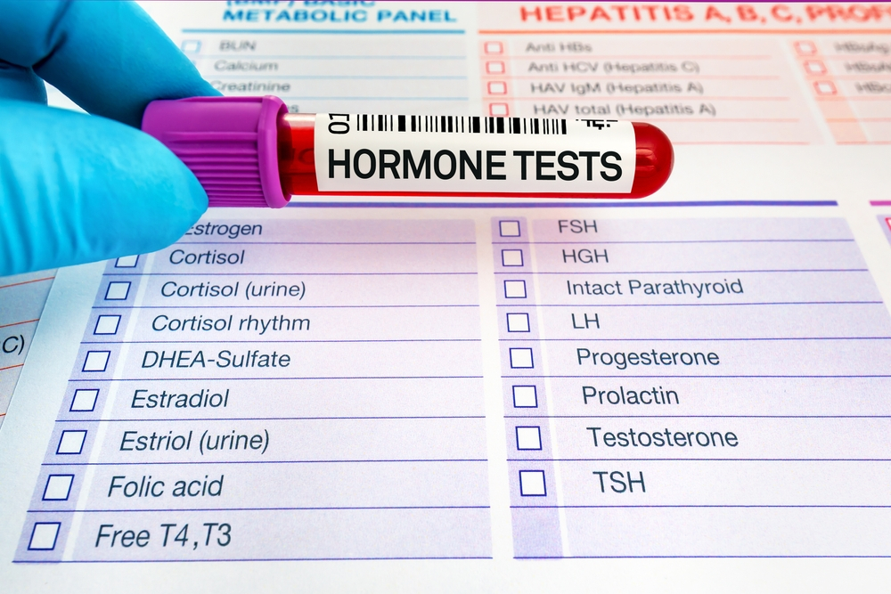 Hormone-Testing-3039288072