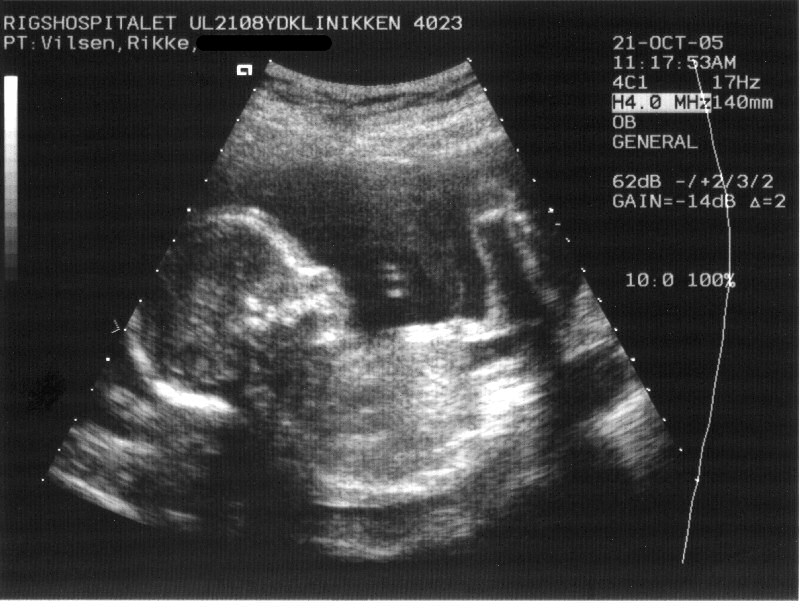 diagnostic_ultrasound-2075176754