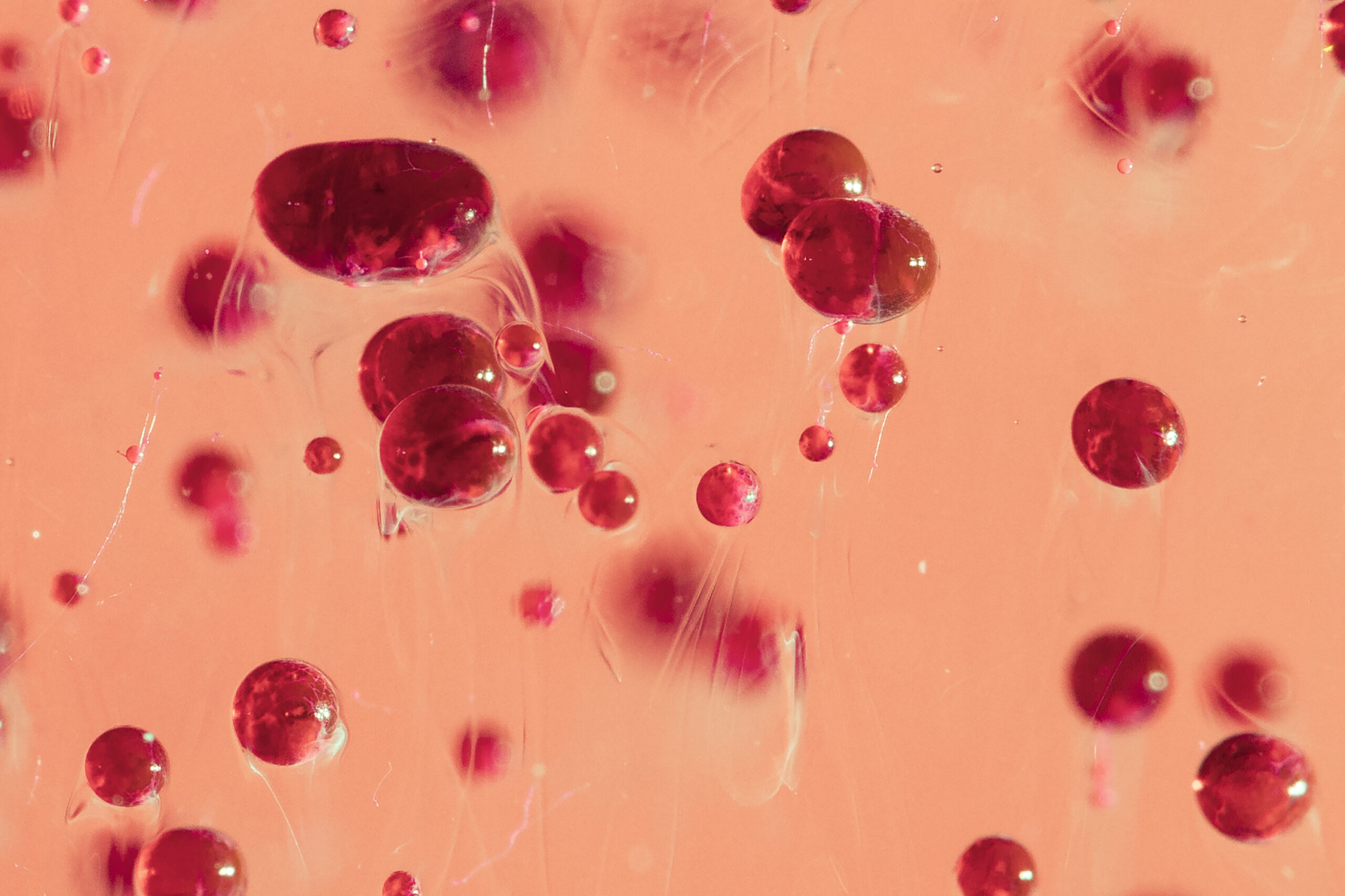 Too Much Iron? Spot the Silent Danger of Hemochromatosis